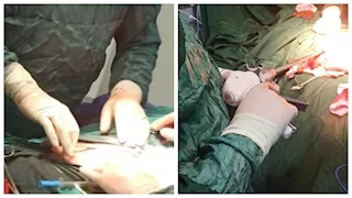 إنقاذ مريض في حالة حرجة بعد تدخل جراحي دقيق بمستشفى أشمون (صور)