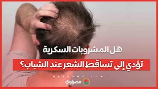 هل المشروبات السكرية تؤدي إلى تساقط الشعر عند الشباب؟