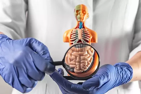 القولون العصبي وأورام القولون- 3 أعراض للتفريق بينهما