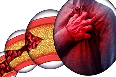 كيف تساعدك بذور الكراوية في إدارة مستويات الكوليسترول؟