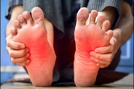 5 أسباب للشعور بحرقان في القدم.. اعرفها