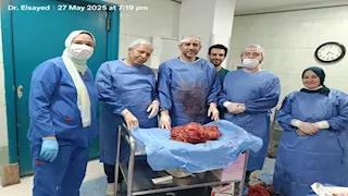 إنقاذ مريض بعد استئصال ورم وزنه 15 كجم بمستشفى النيل للتأمين الصحي
