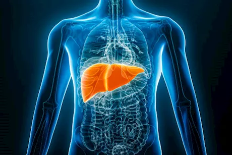 في 3 أشهر- دليلك لعلاج مرض الكبد الدهني