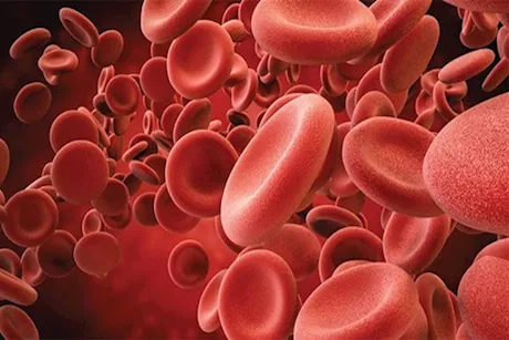 هل ارتفاع الهيموجلوبين خطير؟