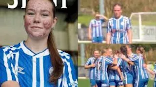 لاعبة تتعرض للتنمر بسبب "حب الشباب".. ودعم رياضي وسياسي