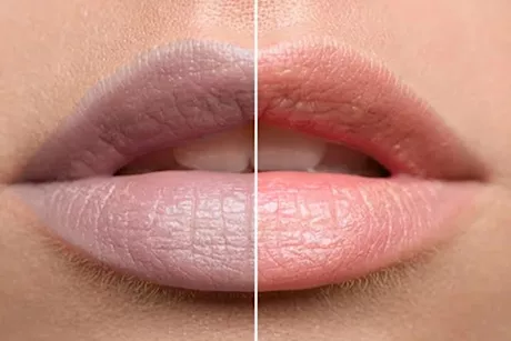 للنساء- 6 وصفات طبيعية لتفتيح الشفاه الداكنة