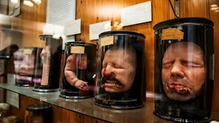 بينها جماجم وأعضاء.. متحف أمريكي يعرض 35 ألف قطعة من بقايا البشر (صور)