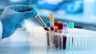 "الرقابة الصحية": اعتماد دولي جديد لدليل معامل التحاليل الطبية 2025