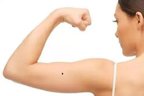 ترند "الحسنة السوداء".. ما حقيقة شامة الذراع الأيسر عند جيل الثمانينات؟  