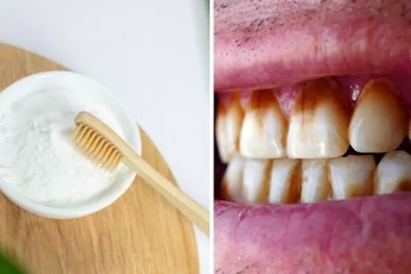 موجود في منزلك- هذا المكون أفضل علاج لاصفرار أسنانك