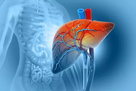 لعلاج الكبد الدهني في 90 يومًا- واظب على هذه الأشياء صباحًا
