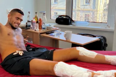 كسر ساقيه متعمدًا- ما قصة ليون أوترمبا؟"فيديوجرافيك"