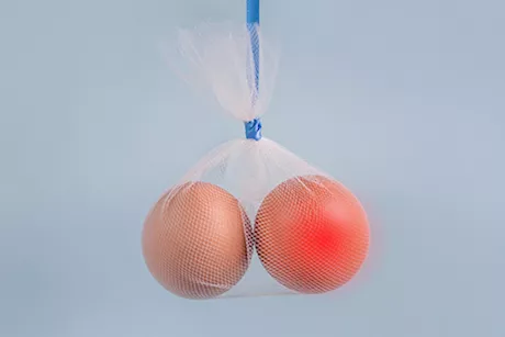 للرجال- 5 علامات مبكرة تكشف عن وجود ورم في الخصية