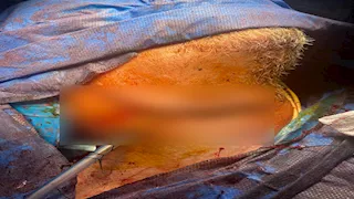 منشار كهربائي يخترق رقبة رجل وهكذا تدخل جراحو جامعة أسيوط لإنقاذه -صور