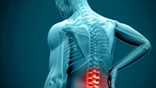 6 نصائح فعالة للوقاية من الانزلاق الغضروفي 