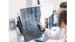 باحثون يابانيون يطورون تقنية دقيقة لمحو الذكريات "تفاصيل"