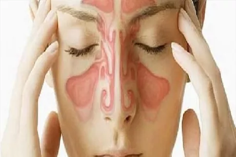 مضاعفات خطيرة لالتهاب الجيوب الأنفية- هكذا يمكنك التعامل معها