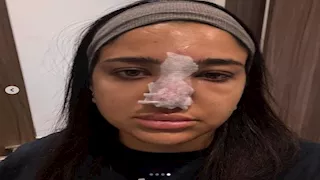 بعد أزمتها مع الفيلر.. 20 صورة لـ كنزي مدبولي