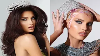 لأول مرة.. متسابقة مصابة بالثعلبة تفوز بلقب ملكة جمال أمريكا 2025 