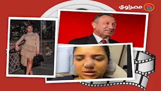 حدث بالفن| أزمة كنزي مدبولي بسبب حقنة فيلر وتعليق وفاء عامر بعد الحكم بحبس "بنت مبارك"