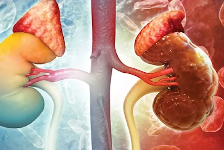 منها البول الرغوي ..أعراض نادرة للفشل الكلوي