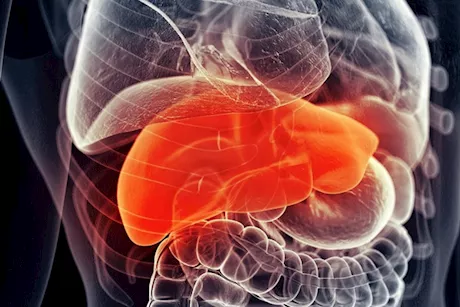 وداعًا للكبد الدهني- 5 خضراوات لعلاجه في 90 يومًا