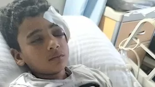 أطفال رشقوا القطار بالحجارة.. طوبة تصيب طفلًا بكسر في الجمجمة بالمنوفية