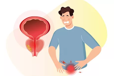 للرجال- 5 علامات تكشف عن وجود مشكلة في البروستاتا