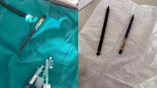 لن تتوقع.. هذا ما استخرجه أطباء من معدة شابة تركية (صور)