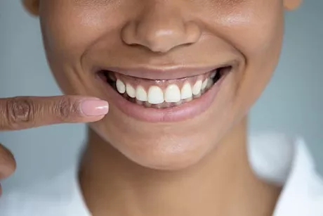 بخلاف بيكربونات الصوديوم- 3 وصفات منزلية لتبييض أسنانك