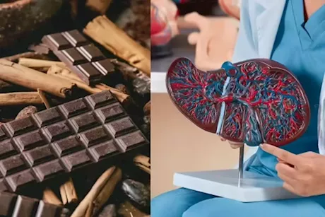 هذه الحلوى تمنع الإصابة بمرض الكبد الدهني