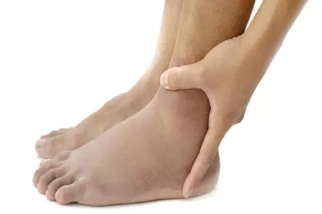 تورم القدمين للحوامل .. إليك أسبابه 