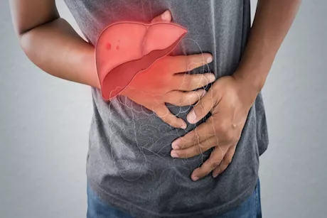 أعراض الكبد المزمن عند النساء .. هل تختلف عن الرجال؟