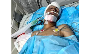 أصيب بشلل نصفي.. كيف تحطم حلم لاعب كرة قدم في غزة برصاص الاحتلال؟