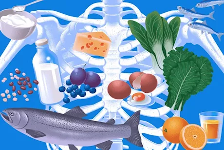 لزيادة كثافة العظام- تناول هذه الأطعمة يوميًا