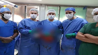 انسداد معوي وطعنة قديمة.. استئصال ورم 7 كيلو من بطن مريض بالفيوم