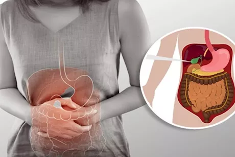 انتبه- 5 علامات تكشف عن وجود مشكلة في المرارة