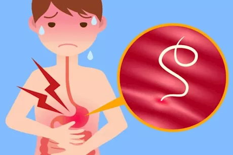 علامات تشير إلى إصابة طفلك بالديدان المعوية- احذريها