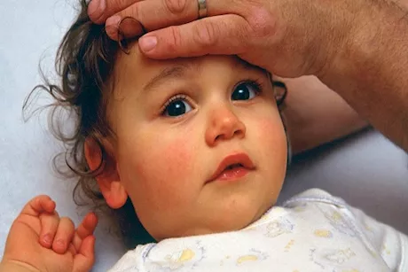 الجفاف عند الأطفال.. الأسباب والأعراض والعلاج