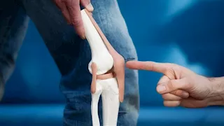 آخر تقاليع التجميل.. نساء يلجأن لجراحة تقصير الساقين لسبب غير متوقع