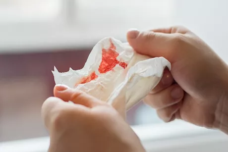 هل البصاق المدمم من أعراض ارتشاح المياه في الرئة؟.. طبيب يوضح