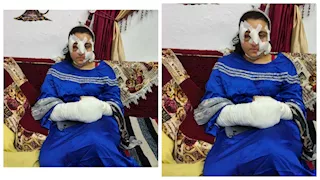 بسبب 500 جنيه.. شاب يمزق جسد شقيقته بعكاز حديدي في الشرقية