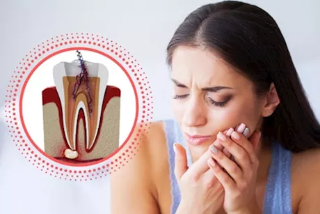 ألم الأسنان بعد الحشو- طبيبة تحذر: هؤلاء أكثر عرضة له "فيديو"