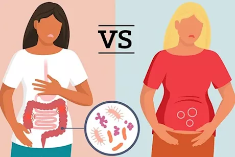انتفاخ البطن والقولون- طبيب يوضح الفرق بينهما