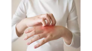 في الشتاء.. لماذا تتورم أصابع اليدين والقدمين وتصبح حمراء؟