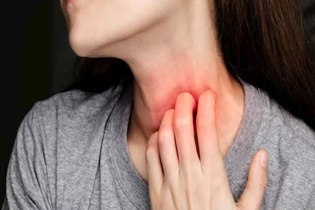 أطعمة تسبب حكة الحلق بعد تناولها في الشتاء