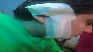 "50 غرزة".. سيدة تتهم طالبا بتمزيق وجه ابنها داخل مدرسة في البحيرة