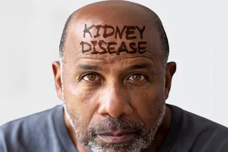 وجه مريض الكلى- 5 أعراض تكشف إصابة كليتك بالتلف