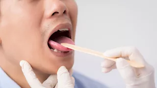 لون لسانك يكشف عن صحتك.. احذر هذه العلامات 