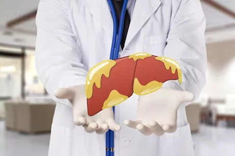 انتبه لهذه التغيرات- إليك علامات شفاء الكبد الدهني على الوجه